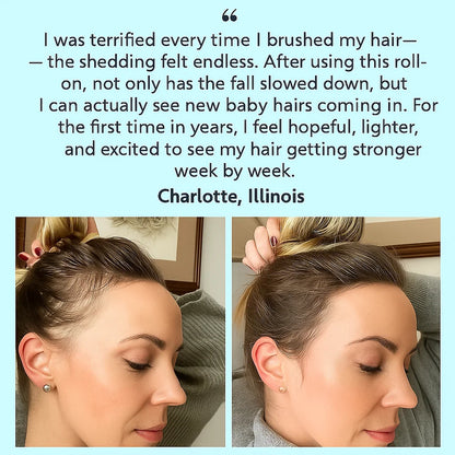 BelleFille™ – Follicle Renewal Roll-On Serum