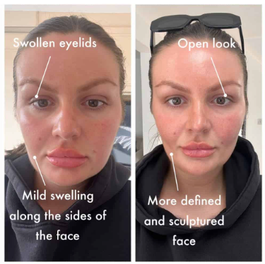 Bellefille Lymphatic Contour Brush