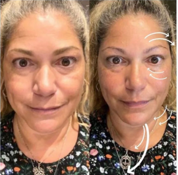 Bellefille Lymphatic Contour Brush