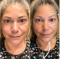 Bellefille Lymphatic Contour Brush