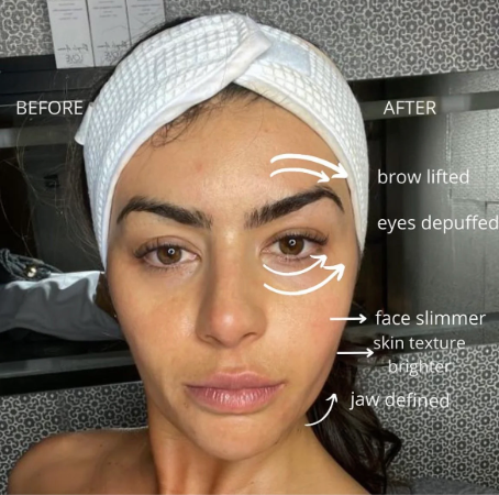 Bellefille Lymphatic Contour Brush