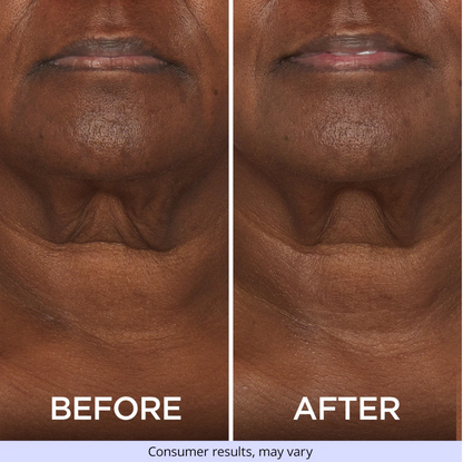 Tighten & Lift Neck Cream